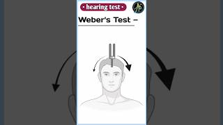 hearing test II webers test [upl. by Florenza]