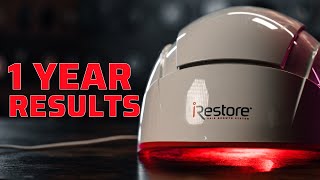 iRestore Laser Hair Growth Therapy 1 Year Test RESULTS [upl. by Womack]