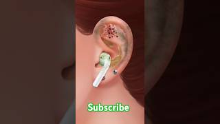 ASMR  Ear Cleaning and Earwax Removal asmranimationdocter ‎asmranimationdocter [upl. by Aloiv962]