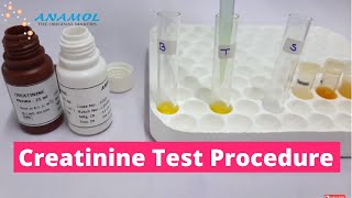 Serum Creatinine Test  Creatinine Blood Test [upl. by Phelan]