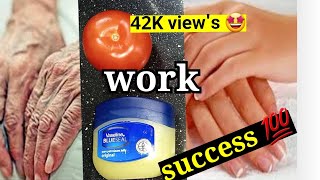 How to make hands soft and wrinkle free with vaseline and tomato how to get rid of rough handssoft [upl. by Ebarta]