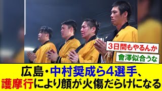 広島・中村奨成ら4選手、護摩行により顔が火傷だらけになる 【プロ野球反応】 [upl. by Hurlow61]