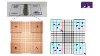 Counting cells on a hemocytometer [upl. by Rafe931]