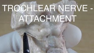 Trochlear nerve  Attachment at brainstem [upl. by Nats]