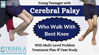 Cerebral Palsy Teenager with Multilevel Problem Walk with Bent Knees treatment plan amp case study [upl. by Sebastiano]