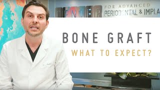 Bone Graft Procedure What to expect [upl. by Kleiman]