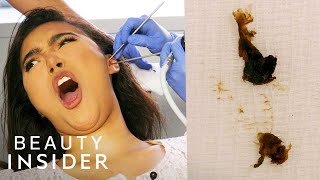 How Earwax Is Professionally Extracted  Beauty Explorers  Insider Beauty [upl. by Glynda]