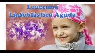 Leucemia Linfoblástica Aguda [upl. by Alimak]