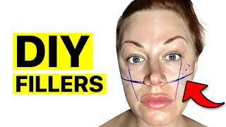 DIY Cheek Filler How I Did Cheek Filler At Home  Surgeon Reacts [upl. by Wernsman944]