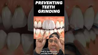 Preventing Teeth Grinding with an Occlusal Guard  In Office to Hands On Dental Training shorts [upl. by Onil]