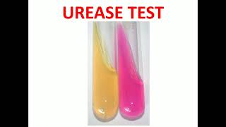 10 Urease Test MLTLectures [upl. by Talmud]