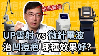 UP雷射 vs 微針電波治療凹痘疤，哪種效果好？皮膚科林政賢醫師點出4大關鍵！ [upl. by Ahsetal]