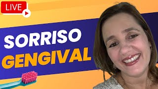 Sorriso gengival [upl. by Aninaig]