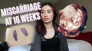 My Miscarriage At 16 Weeks  You are NOT alone Miscarriage Awareness [upl. by Ettenwad]