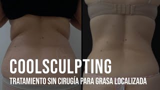 Coolsculpting Tratamiento sin cirugía para la grasa localizada [upl. by Gamal]