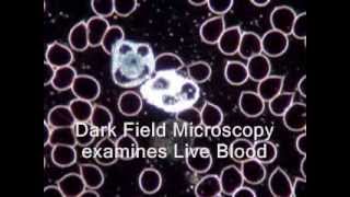 Live Blood Analysis Dark Field Microscopy explained [upl. by Macdougall]