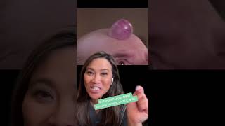 Dr Pimple Popper Explains Forehead Growth [upl. by Daile97]