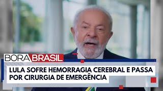 quotPode matarquot As pesquisas dos brasileiros sobre hemorragia cerebral após cirurgia de Lula [upl. by Enixam]