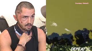 Florida man who survived alligator attack caught on drone video I shouldnt be alive  ABC7 [upl. by Nayar]