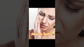 Woman Abscess Tooth pain dentist orthodontist dentalclinicToothAbscessdentistyshortfeedshorts [upl. by Aliel]