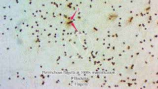 Peritrichous flagella under the microscope [upl. by Bret]