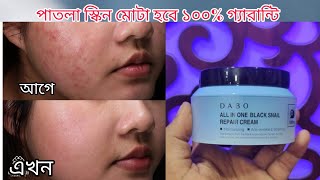 Get MOTA Skin in 7 Days with DABO All In One Black Snail Cream khadija begum [upl. by Nolyag371]