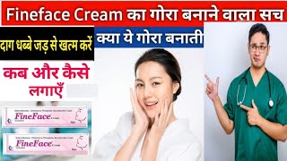 fine face cream  betamethasone clindamycin amp nicotinamide cream  skin whitening cream [upl. by Tamera]