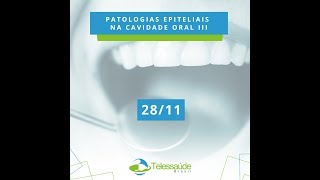 Patologias Epiteliais na Cavidade Oral III [upl. by Melitta]