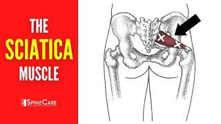 The Sciatica Muscle How to Release It for INSTANT RELIEF [upl. by Gnehp511]