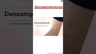 DermatophytosisCPC ExamShorts Medical Coding and Billingmedicalcodercertified [upl. by Biamonte]