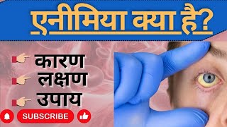 एनीमियाखून की कमी क्या होती है।Anaemia in hindi।Information about anaemia। रक्ताल्पता का अर्थ।। [upl. by Lavro]