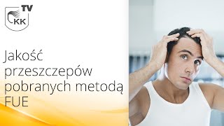 Przeszczep włosów FUE  Jakość przeszczepów pobranych metodą FUE [upl. by Angele]