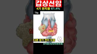 갑상선암 병기 완치율 5년상대생존율 진단thyroid cancer stage 5year survival rate [upl. by Nadnarb]