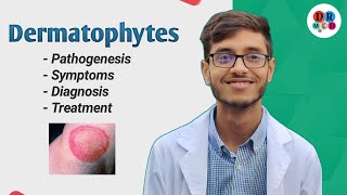 Dermatophytosis  Cutaneous mycosis  Dermatophytes  Microbiology bangla lecture [upl. by Sou787]