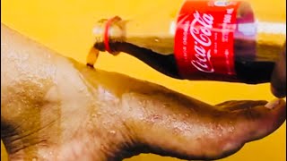 🧋Fizz with Benefits Surprising Health Hacks Using CocaCola🧋FeetHealthHacks ViralVideos foryou [upl. by Howlan]