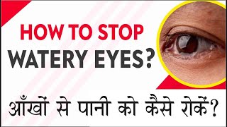 Best Treatment of Watery Eyes  Tear duct blockage problem amp Solutions आँखों से पानी को कैसे रोकें [upl. by Ahar]