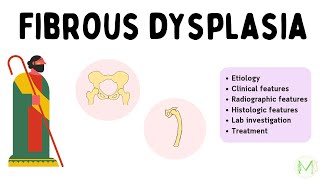 Fibrous dysplasia  In just 6 minutes  Easy explanation  Medinare [upl. by Albertson139]