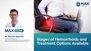 Stages of Piles Hemorrhoids amp Treatment Options  Dr Manish Agarwal  Max Panchsheel Park [upl. by Anolahs]