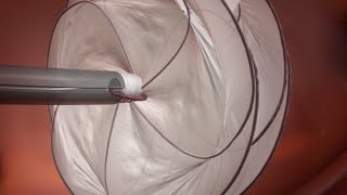 GORE® CARDIOFORM Septal Occluder PFO Animation [upl. by Holly]