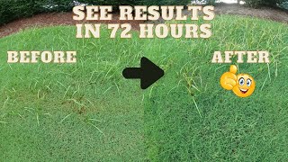 How to kill nutsedge in bermuda grass the easy way [upl. by Schuman283]