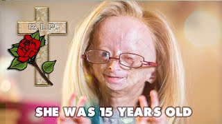 Adalia Rose Girl Who Aged Too Fast Dead at 15 [upl. by Wieren356]