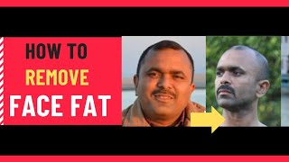 How to lose FACE FAT  মুখৰ চৰ্বি কমোৱাৰ উপায় [upl. by Ltihcox]