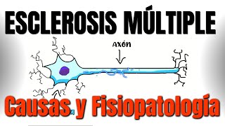 Esclerosis múltiple CAUSAS y FISIOPATOLOGÍA  P1 [upl. by Nnanerak]