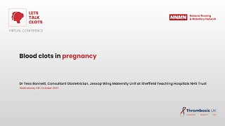 Blood clots in pregnancy [upl. by Madigan]