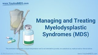 Managing and Treating MDS [upl. by Nnaitsirhc]