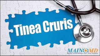 Tinea Cruris ¦ Treatment and Symptoms [upl. by Suillenroc]