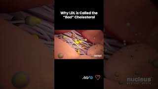 National Cholesterol Awareness Month [upl. by Koo]