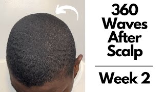 How To Get 360 Waves  Week 2 After Scalping [upl. by Nicholl976]