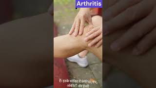 What is Arthritis  Causes Symptoms and Treatment [upl. by Mixie]