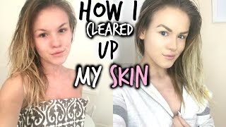 My Winter Skincare Routine  How I Cleared My Skin [upl. by Catherina]